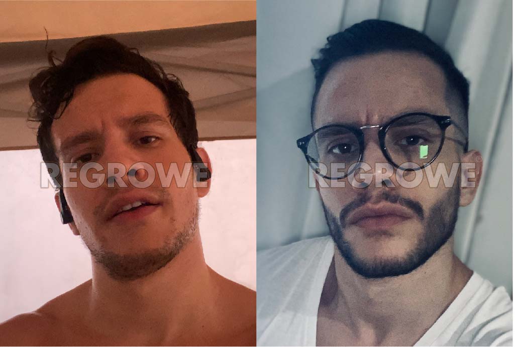 antes%20y%20despues2 18