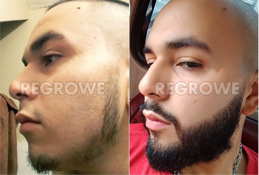 antes%20y%20despues2 19