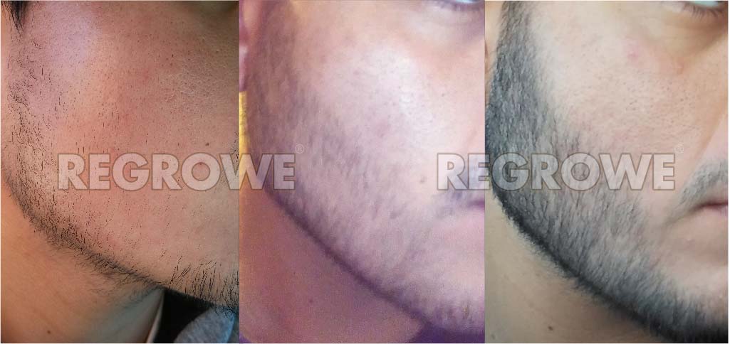 antes%20y%20despues2 20