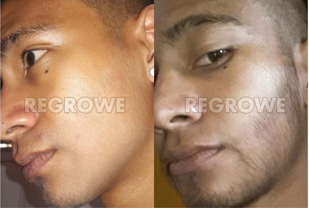 antes%20y%20despues2 21