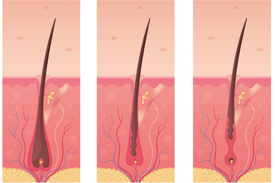 fases de-crecimiento-del-cabello